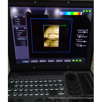 máquinas de ultrasonido portátiles para la venta, sistema de ultrasonido doppler color
